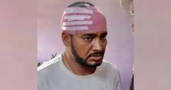 जसपाका पूर्वसांसद साहमाथि आक्रमण