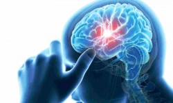 आज विश्व पक्षाघात दिवस मनाइँदै 